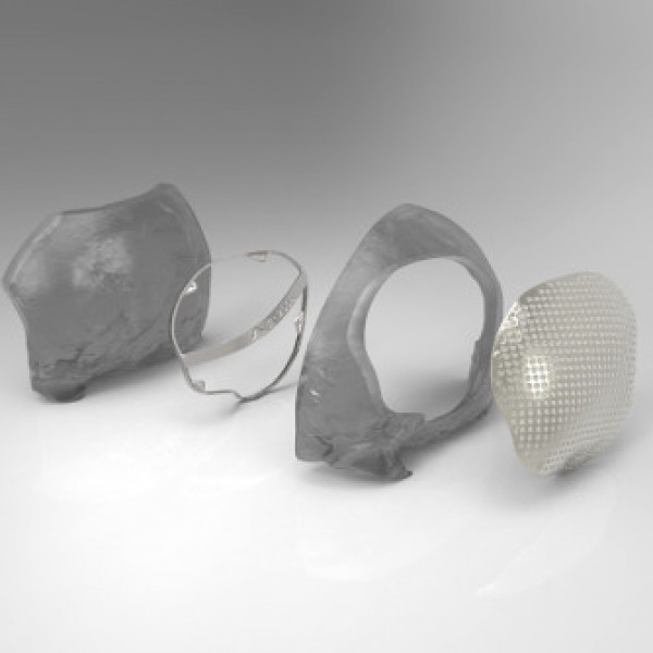 Cranioplasty